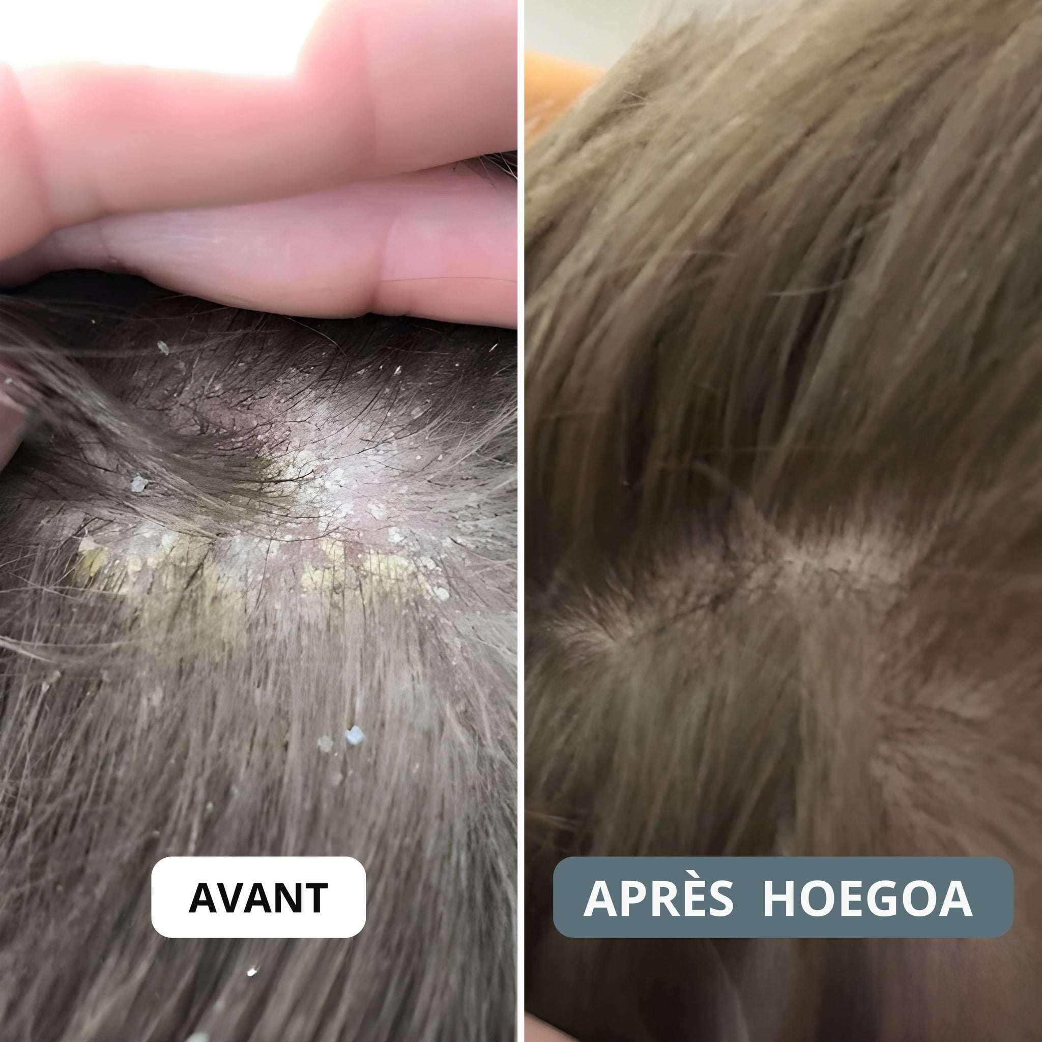 HOEGOA Crème ⎜ Apaise le cuir chevelu et la peau